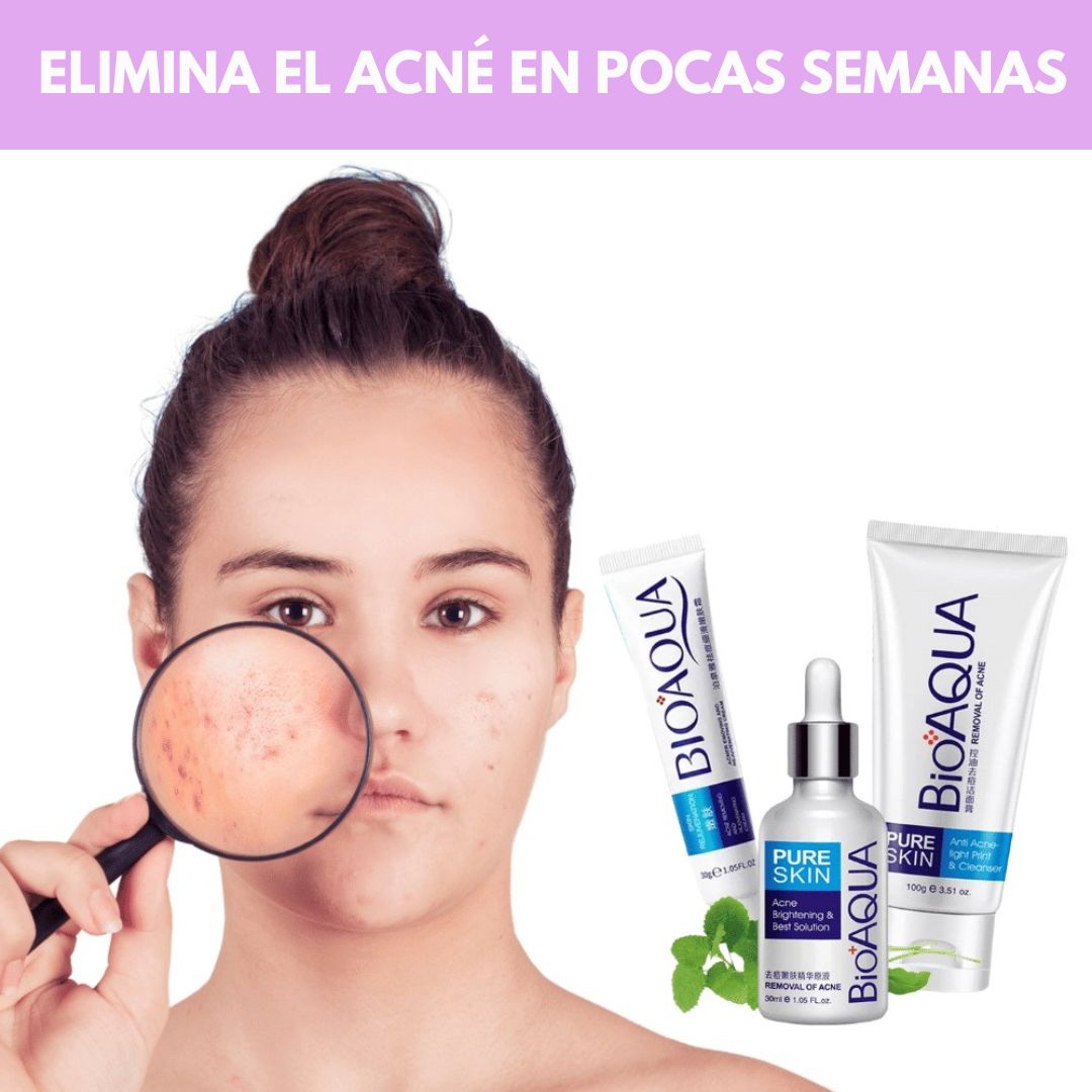 Kit Anti Acné De Bioaqua 3 en 1